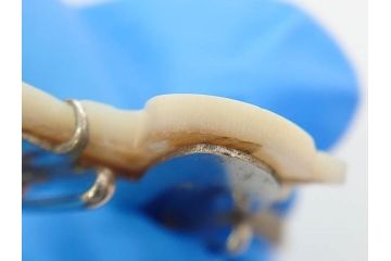 アンティーク　時代物　珊瑚　ピンク　桃色　螺鈿細工　SPM刻印　和の装いを引きたてる帯留6点セット(サンゴ、鯉、魚、竹梅?、帯留め、着物道具、和装小物、アクセサリー)(R-081008)